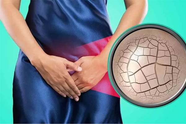 Viêm nhiễm phụ khoa là nhân gây ra khô âm đạo cho chị em