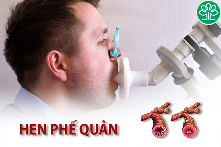 Bệnh hen phế quản không lây qua tiếp xúc cũng như giao tiếp